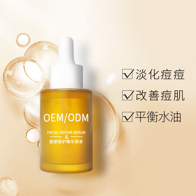 艾维岚_祛痘精华原液OEM